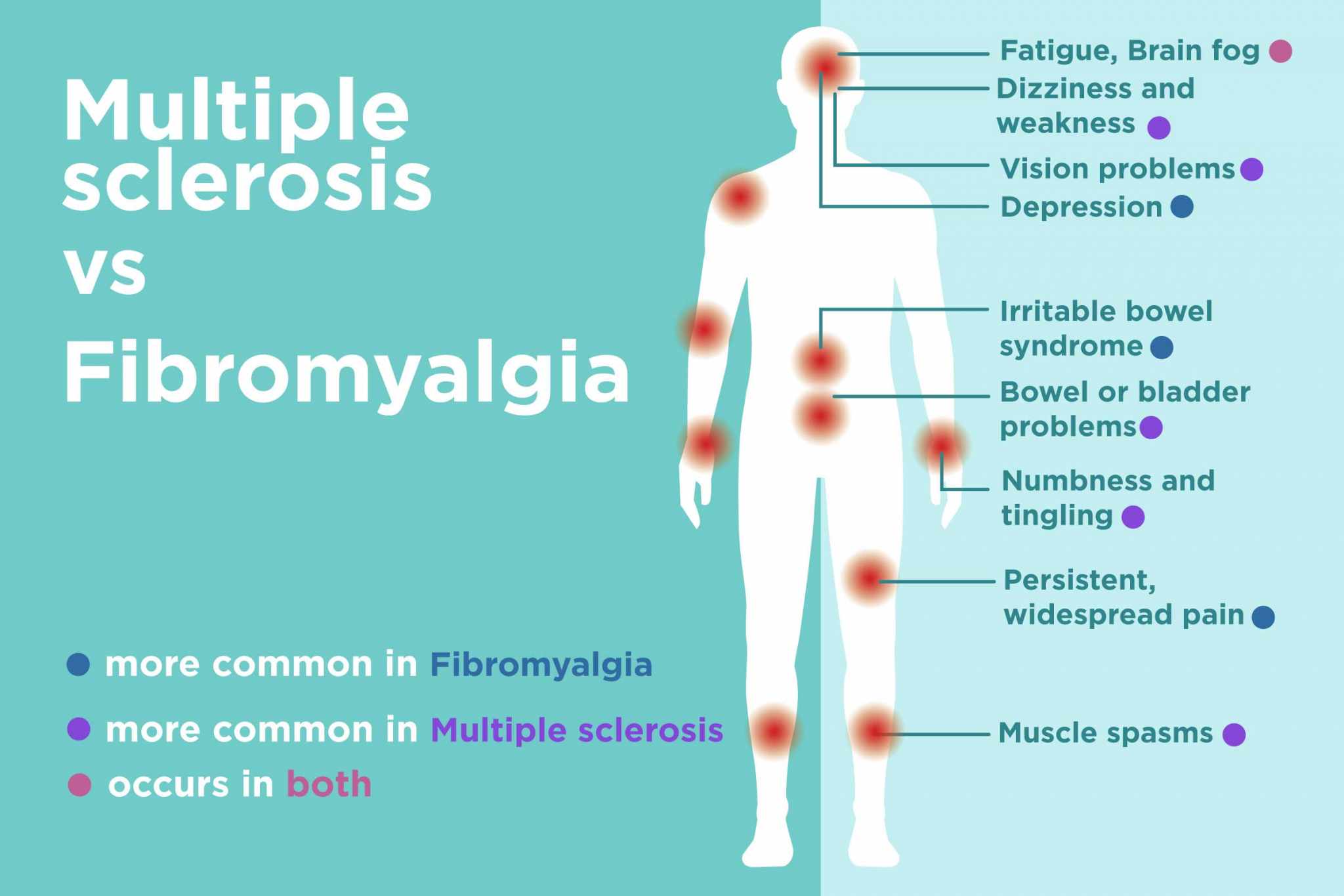 How Is Ms Diagnosed How Is Ms Diagnosedhow Is Ms Diagnosed